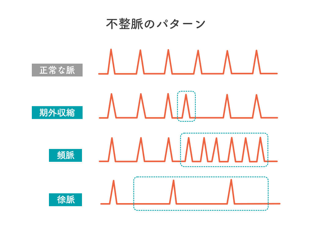 不整脈 ｜栃木県・宇都宮市で不整脈の治療なら宇都宮記念病院